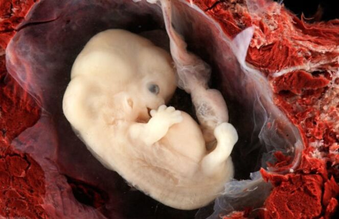 Les pathologies de feto sont possibles